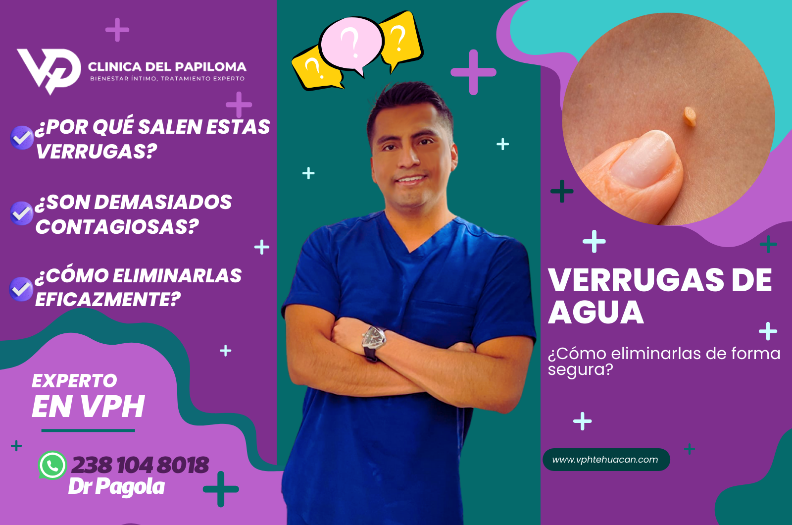 verrugas de agua